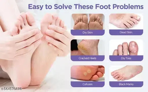 Silky Exfoliating Foot Mask